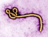 エボラ出血熱のウイルス　.jpg